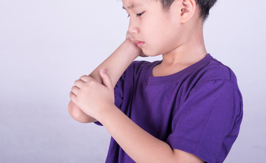 Hiperurisemia pada Anak